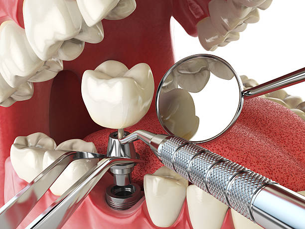 Best Emergency Treatment for Oral Infections in Preakness, NJ